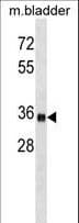 ISLET-1 / ISL1 Antibody (aa156-185)