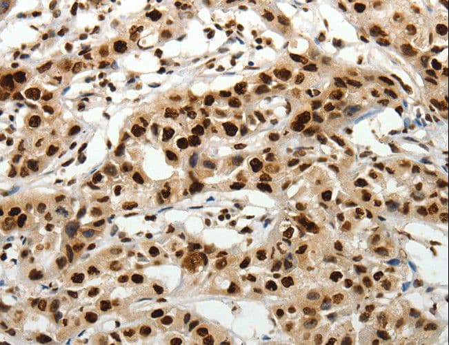 SCN1A / Nav1.1 Antibody