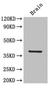 IL12B / IL12 p40 Antibody