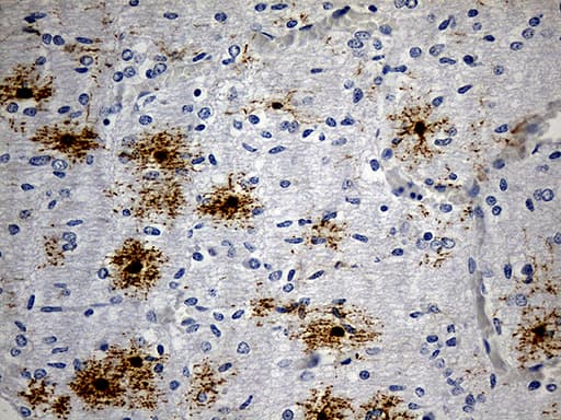 GPR17 Antibody (C-Terminus, clone OTI10B8)