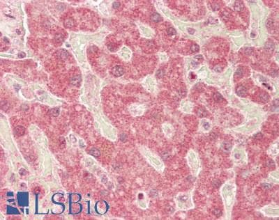 SLC16A1 / MCT1 Antibody (aa215-264)