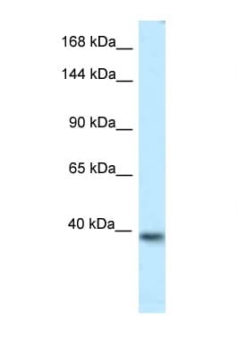 Polyclonal Rabbit anti-Mouse KCNQ2 Antibody (aa182-231, WB)
