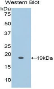 Polyclonal Rabbit anti-Rat FBN1 / Fibrillin 1 Antibody (FITC, aa1475-1638, WB)