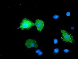 ERBB2 / HER2 Antibody (aa676-1255, clone OTI1D9, Carrier-free)