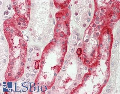 IHC-plus™ Polyclonal Rabbit anti-Human CA12 / Carbonic Anhydrase XII Antibody (aa231-280, IHC, WB)