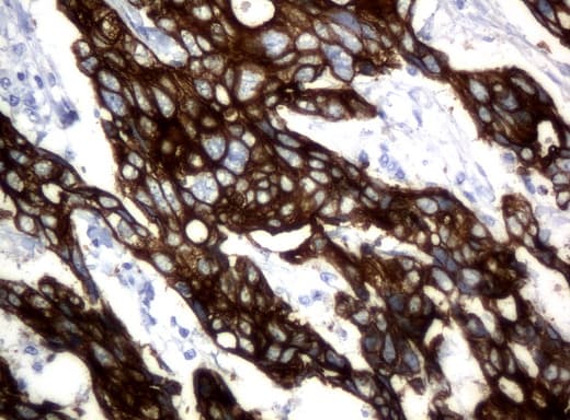 Monoclonal Mouse anti-Human KRT18 / CK18 / Cytokeratin 18 Antibody (clone UMAB50, Carrier-free, aa69-372, IHC, IF, WB)