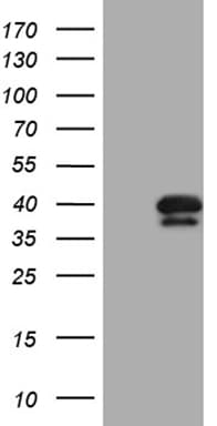 PITPNB Antibody (clone OTI5D11)
