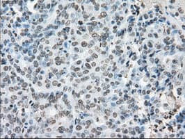 CYPOR / POR Antibody (clone OTI5B3)