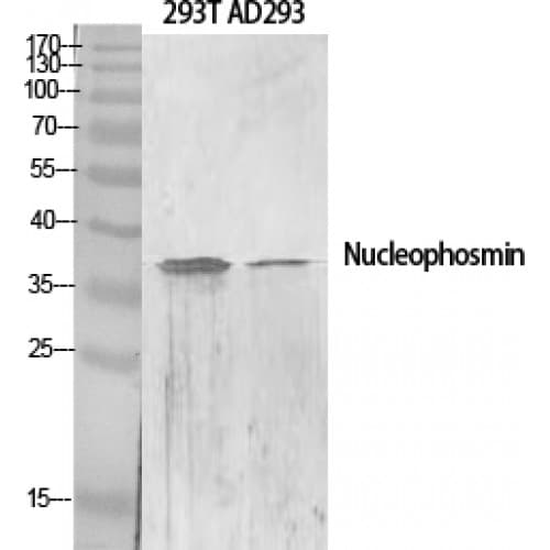 NPM1 / NPM / Nucleophosmin Antibody (10-90 aa, N-terminal)