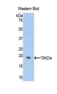GPC1 / Glypican Antibody (aa155-292)