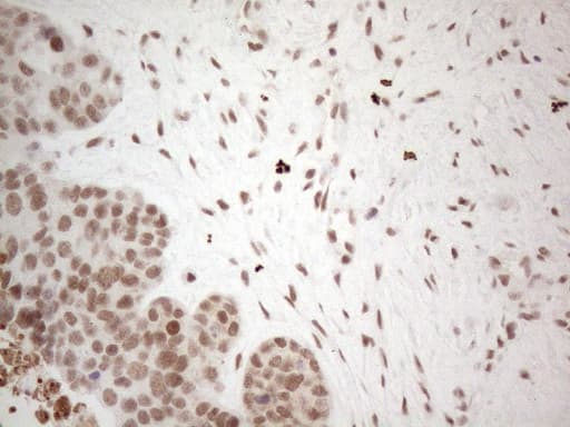 NR2C2 / TAK1 Antibody (aa1-241, clone OTI4B1)