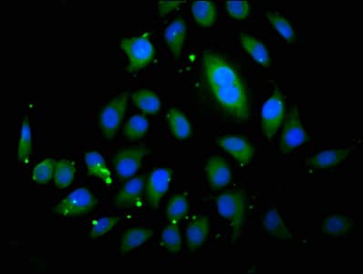 IHC-plus™ ABCB4 / MDR3 Antibody