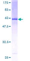 Human RPLP0 Protein (Recombinant GST)