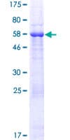Human RSPH14 / RTDR1 Protein (Recombinant GST)