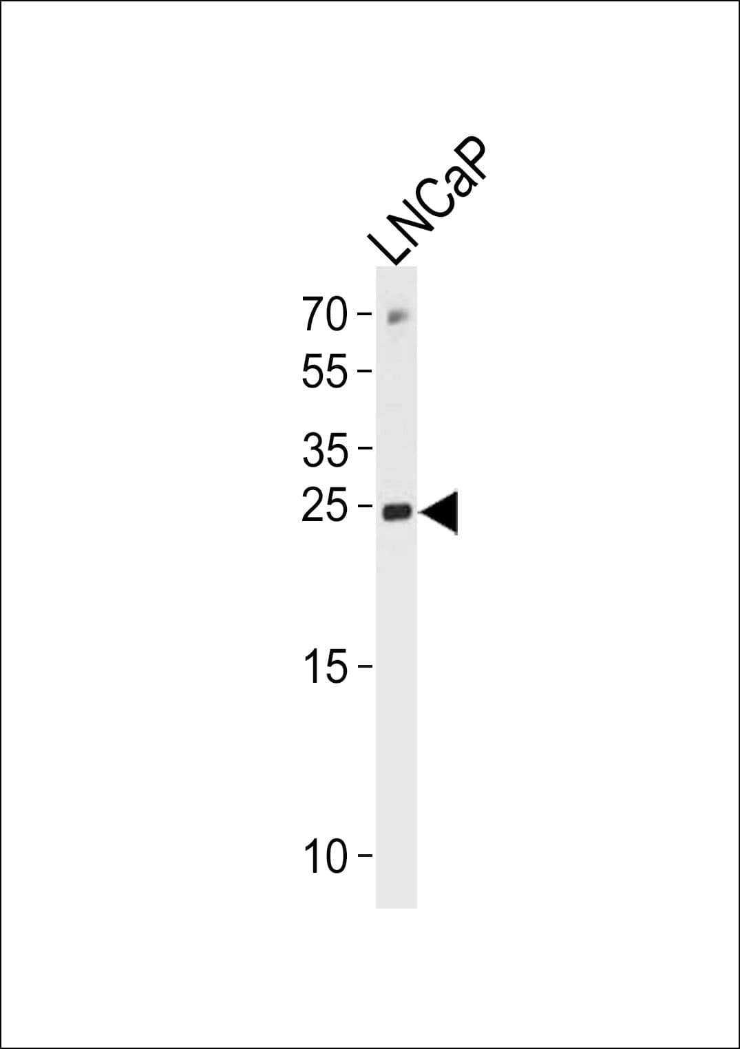 TPT1 / TCTP Antibody (aa85-113)