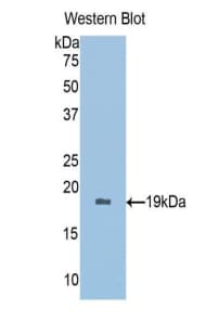 PRDX5 / Peroxiredoxin 5 Antibody (aa1-162)