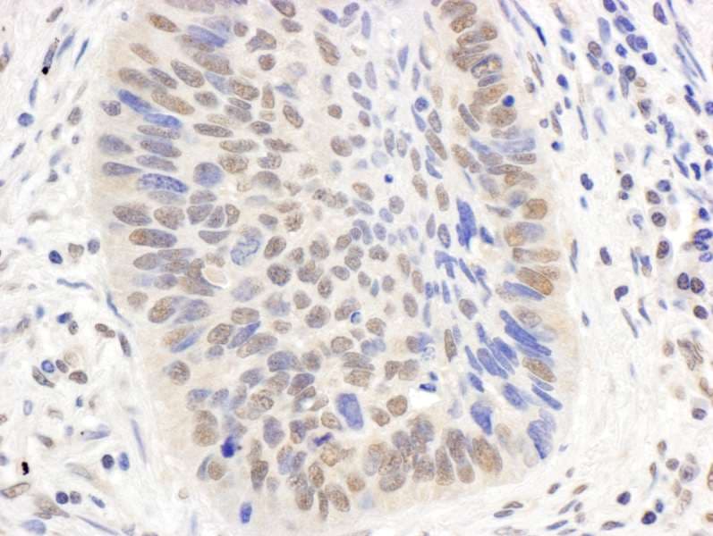 EP300 / p300 Antibody (aa1000-1050)