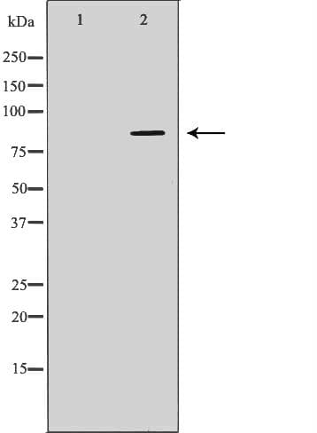 Polyclonal Rabbit anti-Human MAPT / Tau Antibody (IHC, WB)