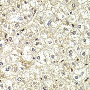 LAMB2 / Laminin Beta 2 Antibody