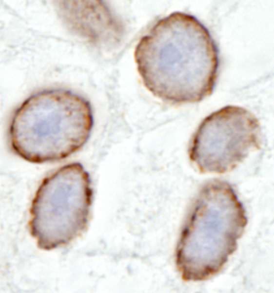 TPR Antibody (aa2300-C-term)