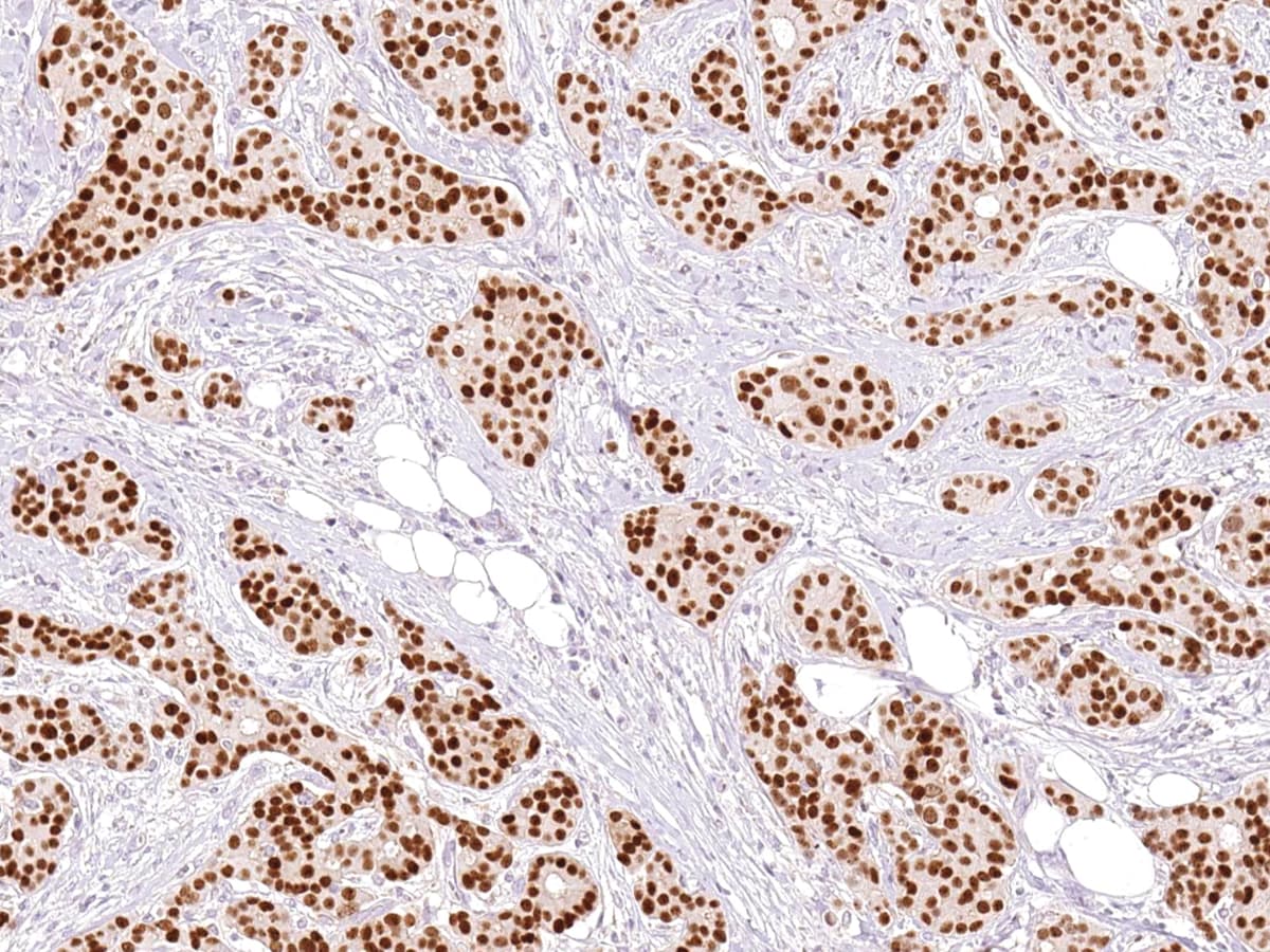 GATA3 Antibody (Ready-to-Use)