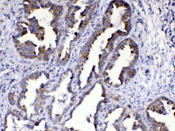 AMD / AMD1 Antibody