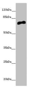 CACNB1 Antibody