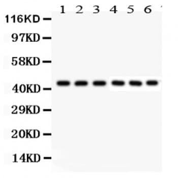 KIN17 / KIN Antibody (aa3-202)