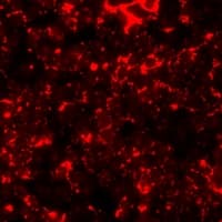 HSPB8 / H11 / HSP22 Antibody