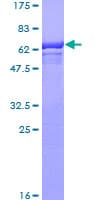 Human Mannose Phosphate Isomerase Protein (Recombinant GST)