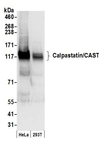 CAST / Calpastatin Antibody (aa658-708)