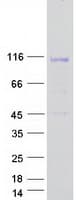 Human LEMD3 / MAN1 Protein (Recombinant Myc-DDK (Flag))