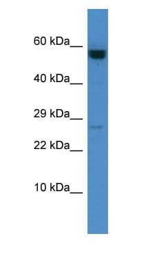 CASP10 / Caspase 10 Antibody (C-Terminus)