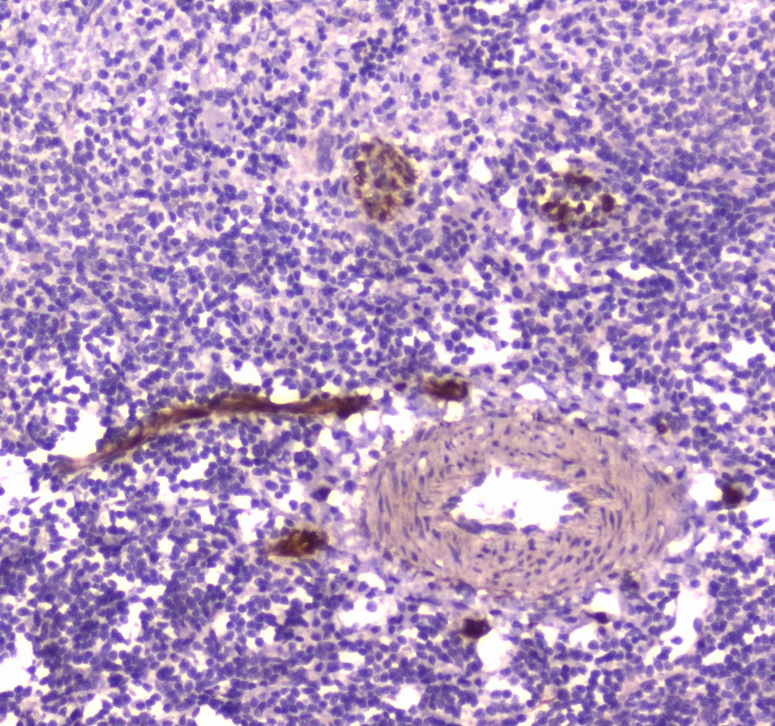 CD163 Antibody