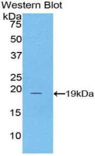 ADRA1A Antibody (aa330-466)
