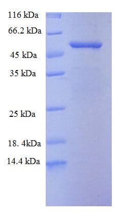 Human ADAM15 Protein (Recombinant GST)