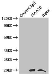 NAT5 / NAA20 Antibody (aa49-178)