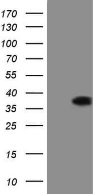DECR1 Antibody (clone OTI5D12)