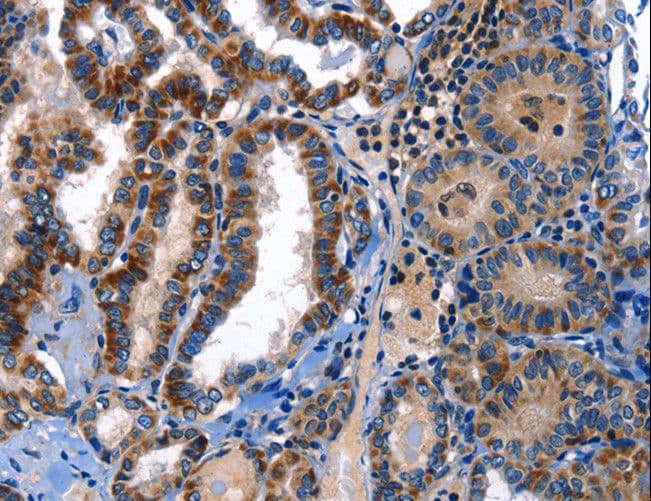 STAT5A Antibody
