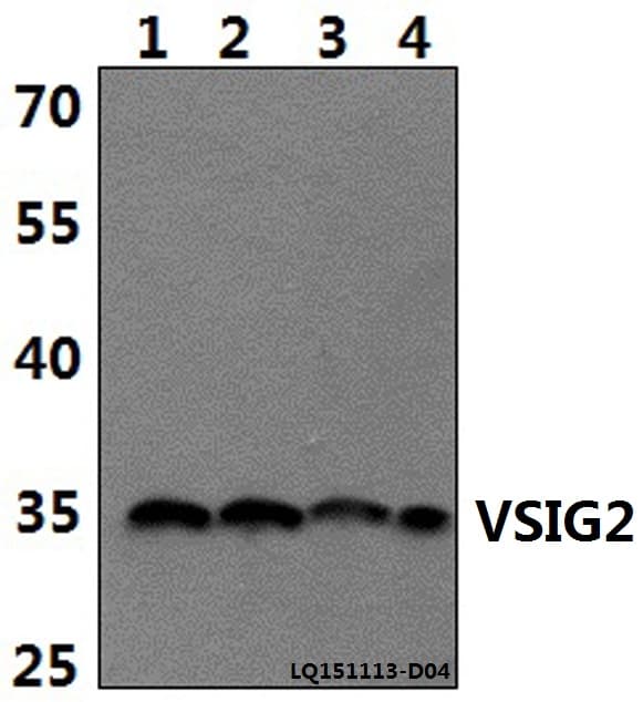 VSIG2 Antibody