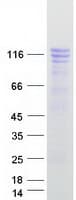 Human GTF3 / GTF2IRD1 Protein (Recombinant Myc-DDK (Flag))