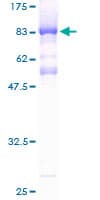 Human CHD2 Protein (Recombinant GST)