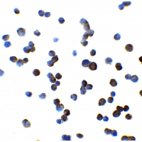 Polyclonal Rabbit anti-Human SLCO1B1 / OATP2 Antibody (IF, WB)
