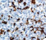 Monoclonal Mouse anti-Human FSCN / Fascin Antibody (Ready-to-Use, IHC)