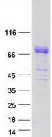 Human SERPING1 / C1 Inhibitor Protein (Recombinant Myc-DDK (Flag))