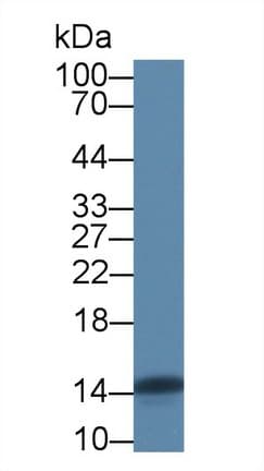 FABP4 / AP2 Antibody (aa1-125, Biotin)