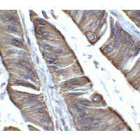TET2 Antibody