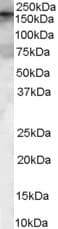 IHC-plus™ ARHGEF5 Antibody (aa476-487)