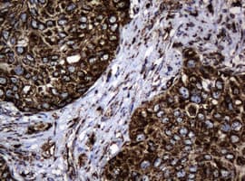 HSPD1 / HSP60 Antibody (clone OTI3G1)