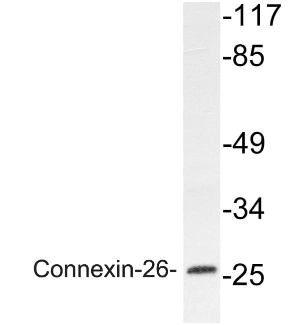 Polyclonal Rabbit anti-Human GJB2 / CX26 / Connexin 26 Antibody (aa45-94, WB)